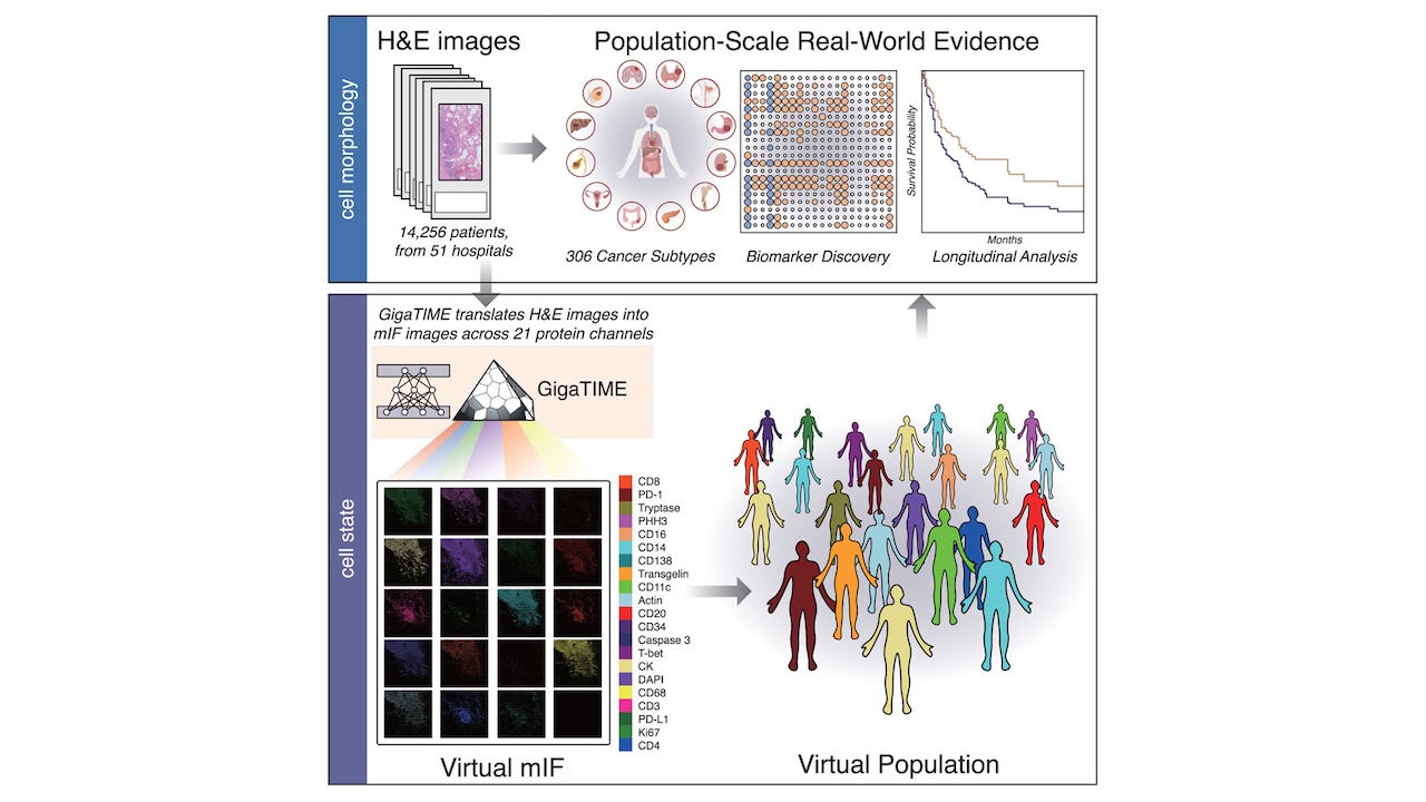 Le modèle d'IA open source « GigaTIME » de Microsoft et Providence pour réduire les coûts de la recherche sur le cancer